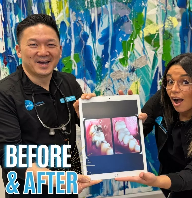 Two dental professionals from Smile Avenue Cypress TX display a before and after image of dental work on a tablet. The background features vibrant abstract artwork. Text on the image reads 'BEFORE & AFTER.'